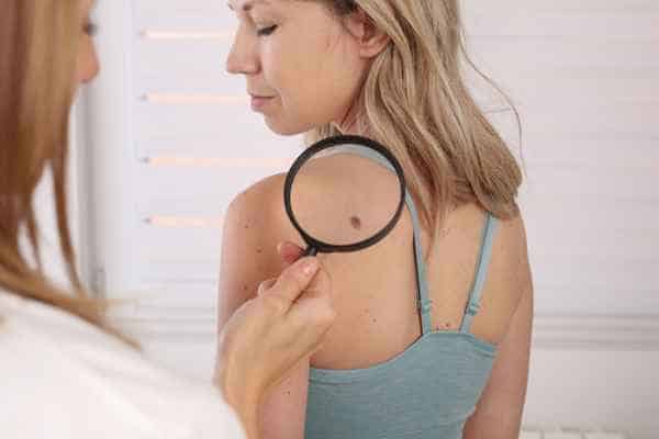 What Are Traditional Skin Lesion Removal Methods Braintree?