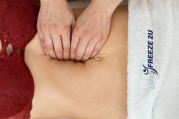 diastasis recti treatment Braintree