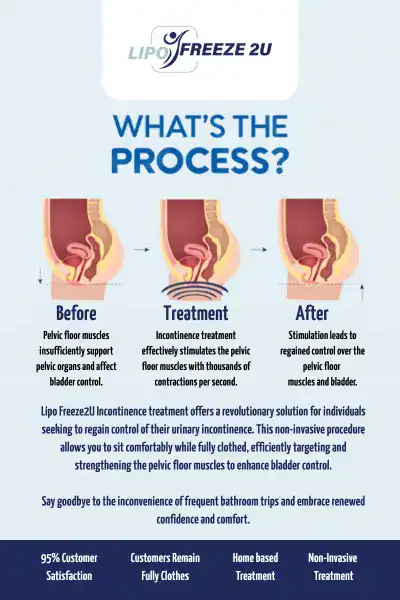 Diagram of how incontinence treatment Braintree works.