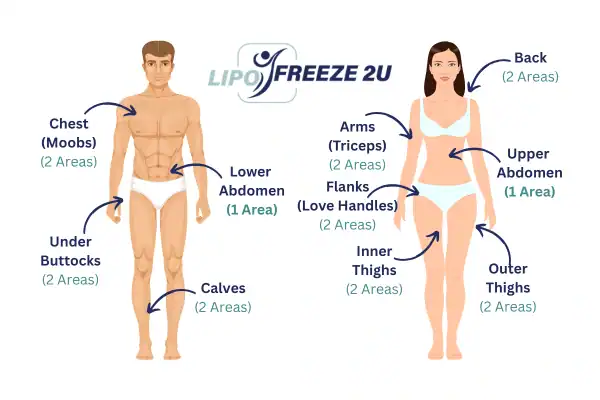 Areas you can have fat freezing treatment Braintree