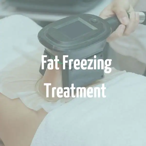 fat freezing treatment Braintree