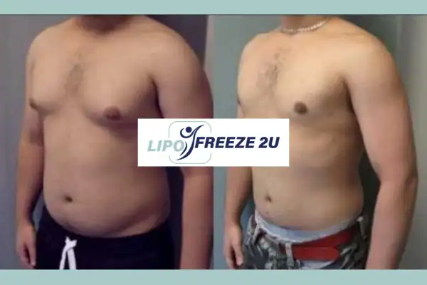 How Long Does It Take to See Results Braintree?
