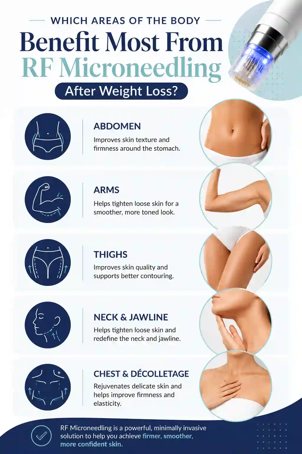 Which Areas of the Body Benefit Most From RF Microneedling After Weight Loss Braintree